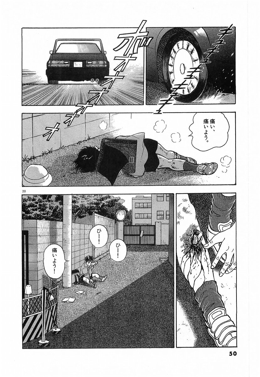 20
